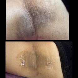 Intimating Bleaching 