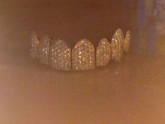 Diamond-Set Gold Dental Grillz Top Row