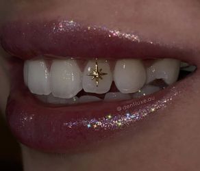 Tooth Gems