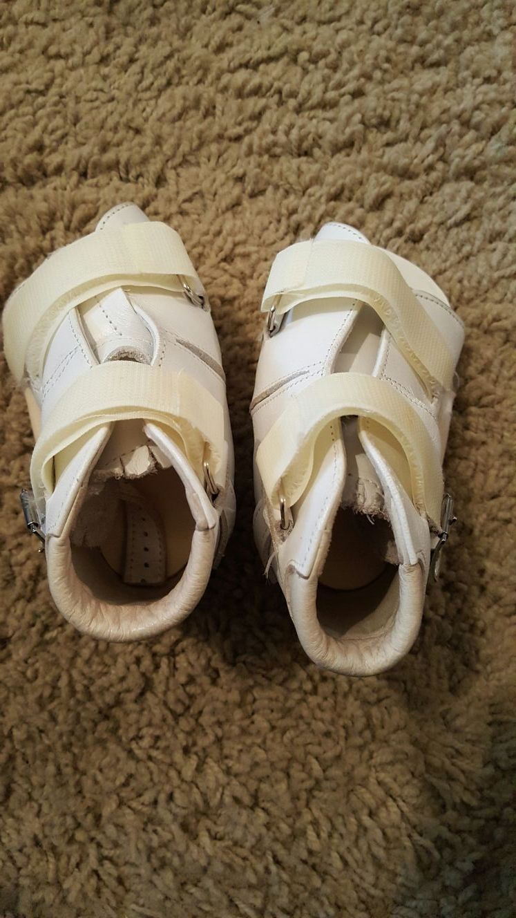 Shoes For Baby with Club Feet Leather