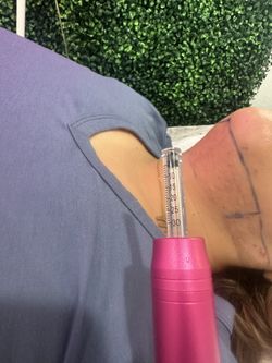 Chin Fat Dissolver