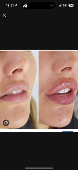 Rusos Lip 