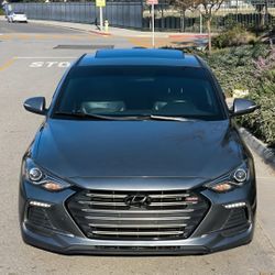 2018 Hyundai Elantra