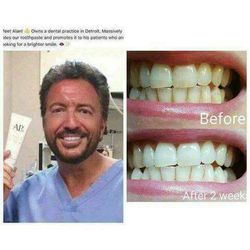 AP24 Teeth Whitening