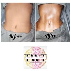 Maderotherapy Wood Therapy 