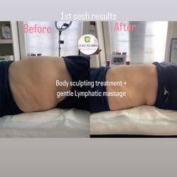Body Sculpting