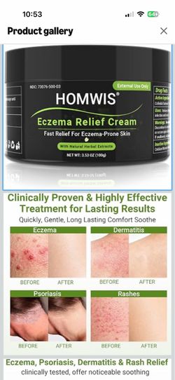 Eczema Cream, Psoriasis, Dermatitis & Rashes Treatment, Moisturizer for Dry, Itchy & Sensitive Skin, Face, Scalp & Body Soothing, Eczema Itch Relief, 