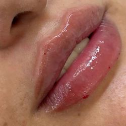 beauty Lip Filler ! ! 