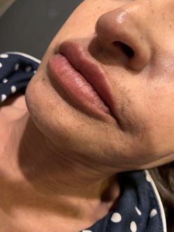 New Lips 👄