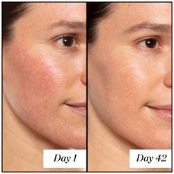 Sunday Riley A+ Serum