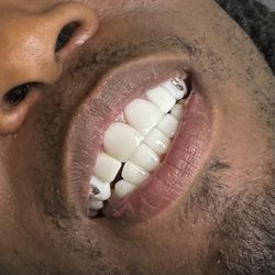 Teeth