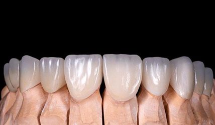 Laboratorio Dental Dental Lab Zirconia Crowns