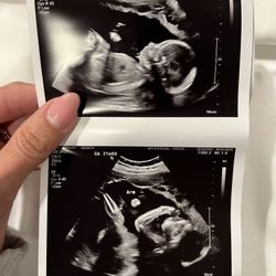 Baby Ultrasound/ Gender Reveal 