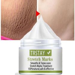 50G/TRSTAY Stretch Mark Cream removes scars and marks