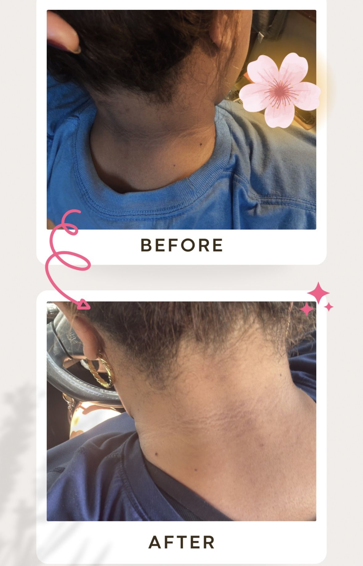 Mayrel lightening cream