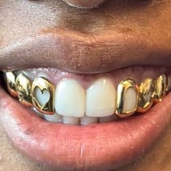 Gold