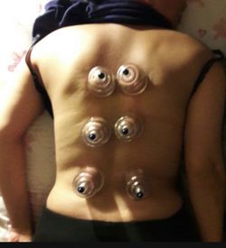 Sobada Massages Ventosa