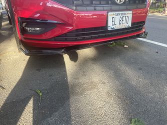 Universal Lip