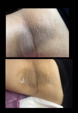 Intimating Bleaching 