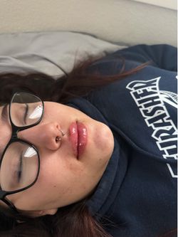 Lip filler
