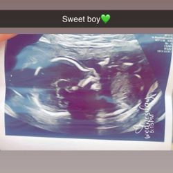 In Need Of Newborn Diapers And Stage 1 