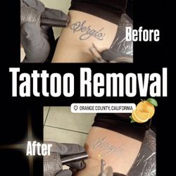 Removal