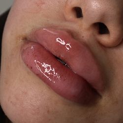 Lip filler/eyebrows/lashes