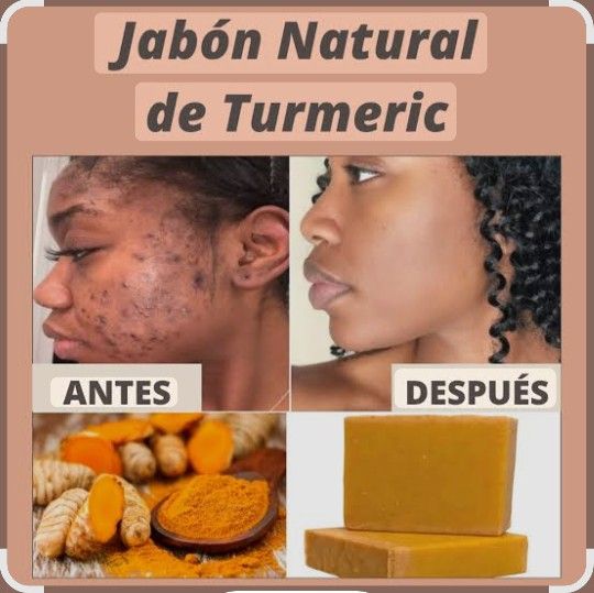 Tumeric Soap/ Jabon De Curcuma 