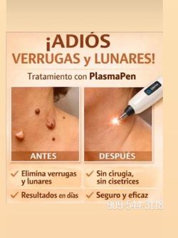 Quita verrugas