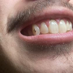 Tooth Gems