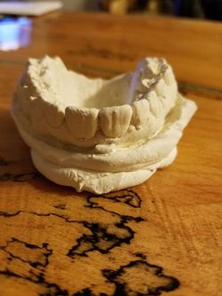 Plaster Dental Casting
