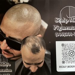 Hair Loss Solution