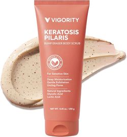 Vigority KP Bump Eraser Body Scrub: Keratosis Pilaris Treatment for Strawberry Legs 250 g $7.99