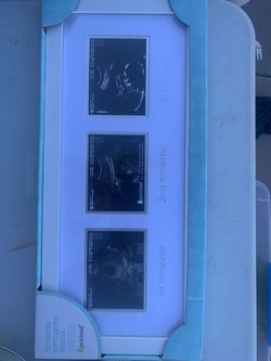 Pregnancy Sonogram Picture Frame new 