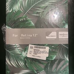 Tropical Palm MacBook Case