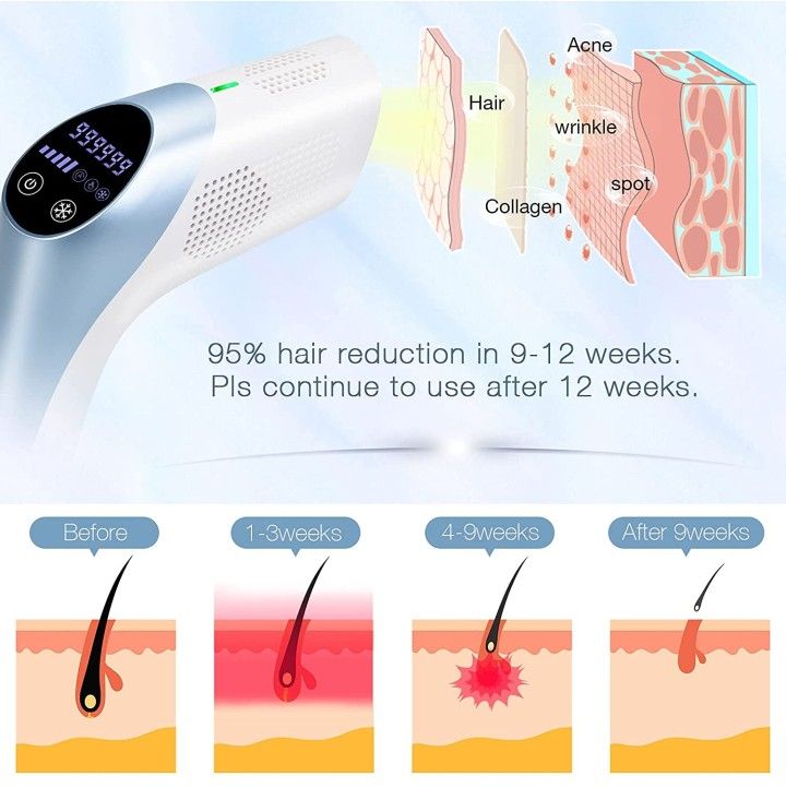 Flashes MiSMON IPL Hair Removal for Women and Men, 3-in-1 Skin Care Beauty Device - Powerful 18J / Ice Compress/Painless/Permanent Result