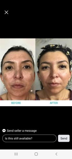 Whitening Soap For Dark Spots Para Todo Tipo De Manchas Obscuras Paño Rodillas O Cuello AXILA