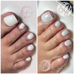 Pedicure
