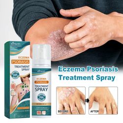 Herbal Eczema & Psoriasis Relief Spray - Fast-Acting Itch, Redness & Skin Repair (100ml) New 