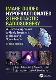 Image – Guided Hypofractionated Sterotactic Radiosurgery