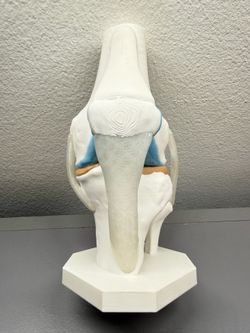 STRATA 3D Prints - Knee Anatomy Model