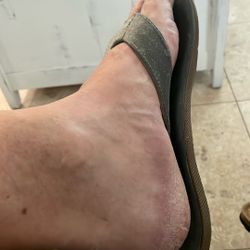 My Foot