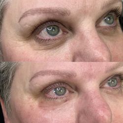 Skin Care / Eye booster 👀✨