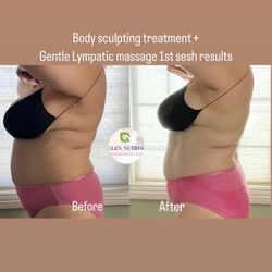 Body Sculpting Body Contouring Slimming Treatments