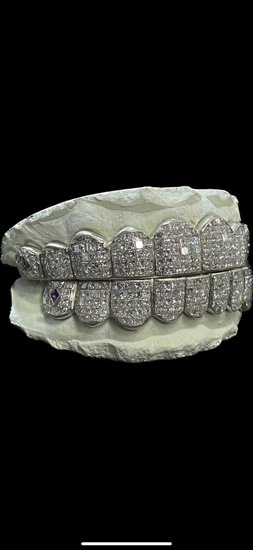 Vvs diamond Grillz