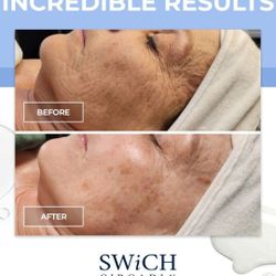 Facial Treatment 