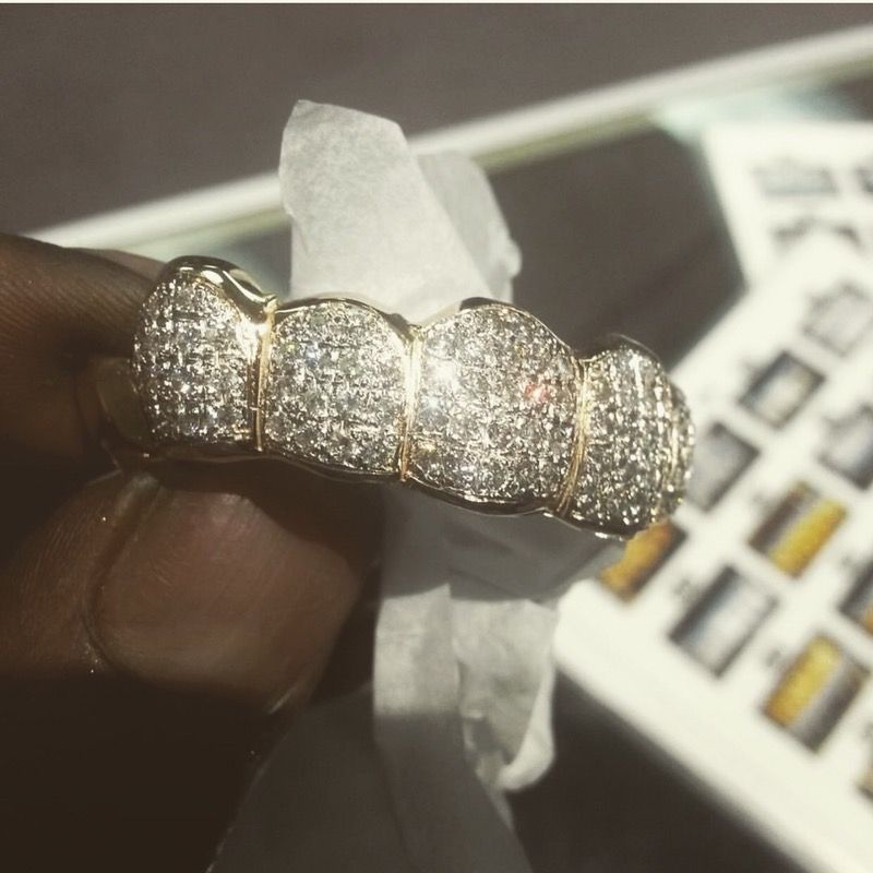 Custom Grillz