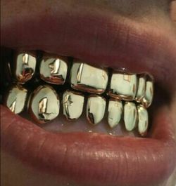 Gold grillz