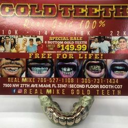6 Bottom Gold Teeth Grillz Special For Sale In Miami Fl Offerup