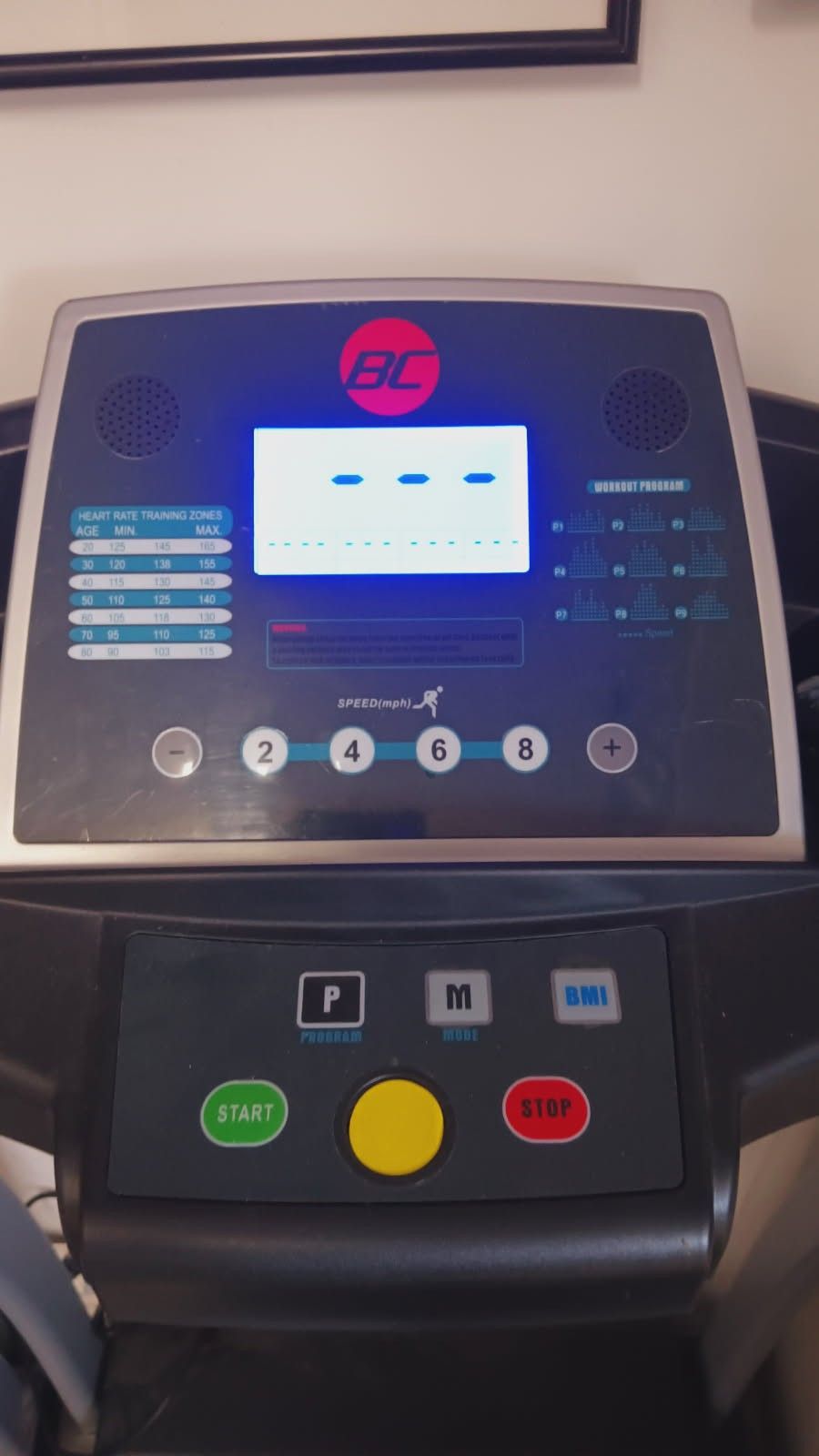 Treadmill Exc Condition Set Of 2